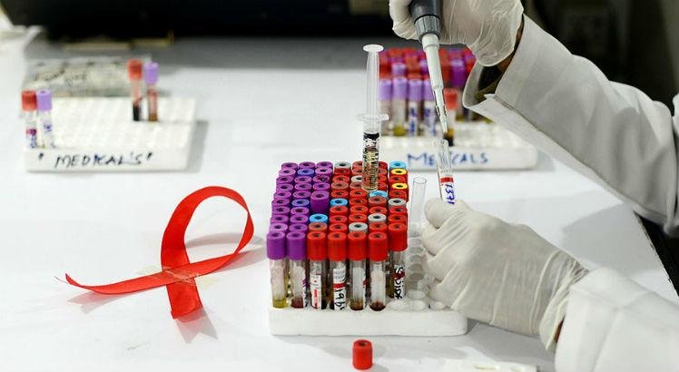 Após pesquisa, paciente está curado do HIV há 14 meses