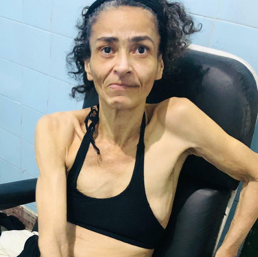 Pacientes sem memória ou relação com parentes, vivem em hospitais, mesmo após fim de tratamento