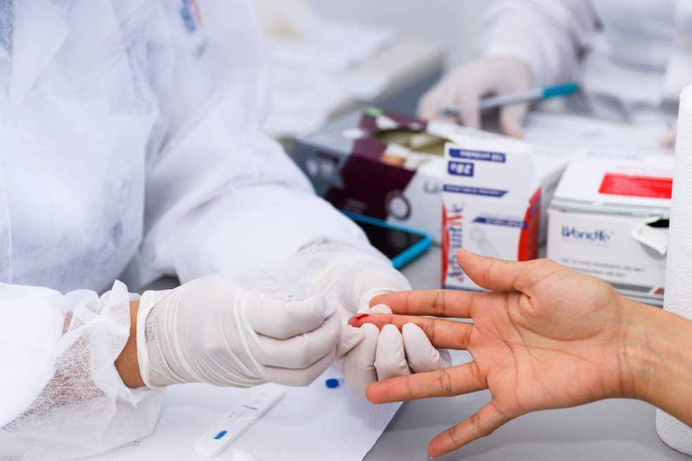 Novo exame para diagnóstico para covid-19, 100% brasileiro, é aprovado pela Anvisa