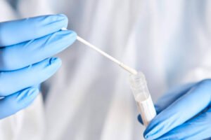 Teste é do tipo swab (foto: reprodução)