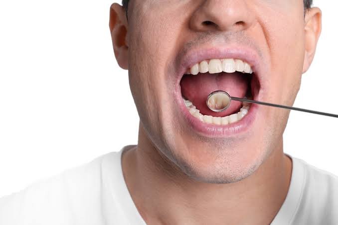 Lesões na boca: entenda quando pode ser um câncer e quais fatores de risco