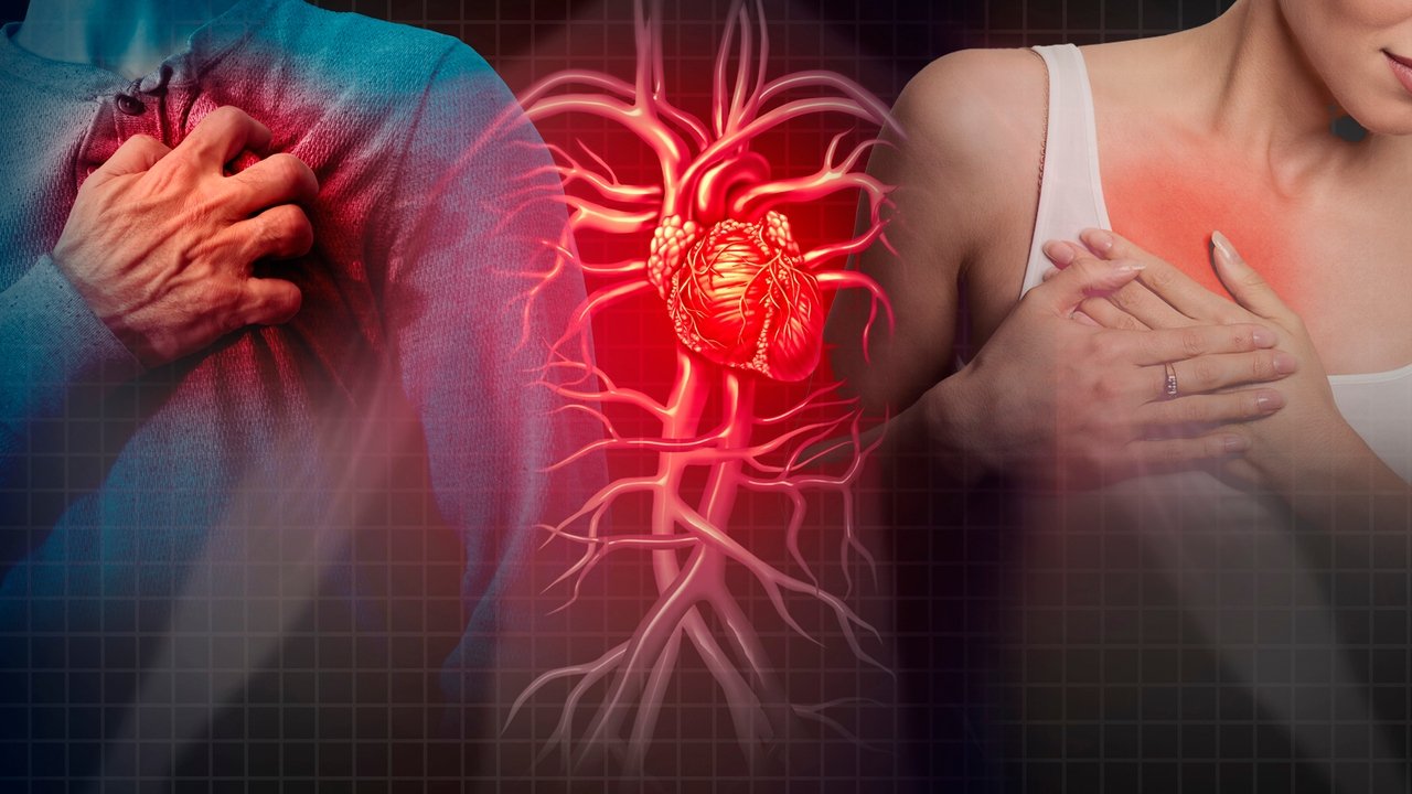 infartos-hombres-mujeres_69